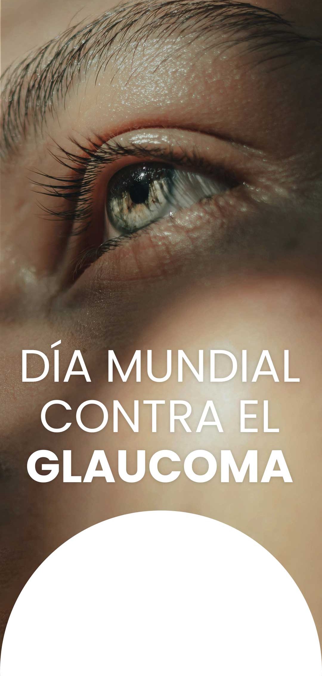 glaucoma_01